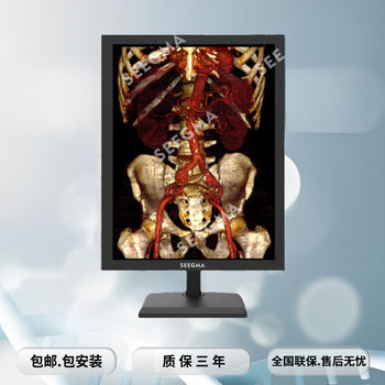 3M Color Medical Display Diagnostic CT Vertical Screen Grayscale Medical Display Medical Display 21.3 Inch