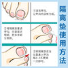 Nail Groove Corrector Ingrown Toenail Universal Filling Pad Toenail Prevention Tool for Preventing Nails from Growing into the Flesh Nail Correction Tool