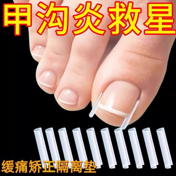 New Foot Nail Groove Repair Patch, Ingrown Toenail Corrector, Filling Pad, Anti-Slip Silicone, Comfortable Fitting Tool