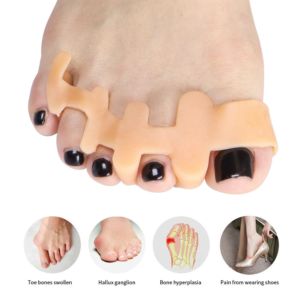 Wholesale Sebs Hallux Valgus Correction Day and Night with Overlapping Toe Toe Separator Bridge-Shaped Five-Hole Hallux Toe Separator