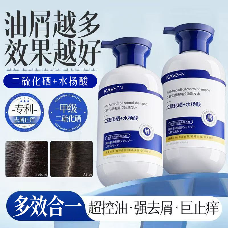Selenium Disulfide Shampoo, Anti-Dandruff, Anti-Itch, Scalp Mite Removal Shampoo, Unisex, Oil Control, Fluffy, Improves Hair Follicles