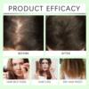 REMIMPI Anti-Hair Fall Hair Loss Shampoo Shampoo Promotes Hair
