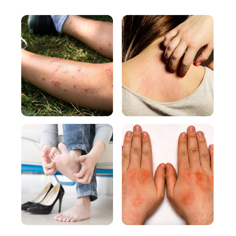 Qidu Pianxiankang Spray and Cream Set Wholesale, Products from the Source Factory, Dropshipping Available