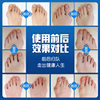 New toe corrector thumb valgus correction split toe Big Foot Bone free adjustment bending separation corrector