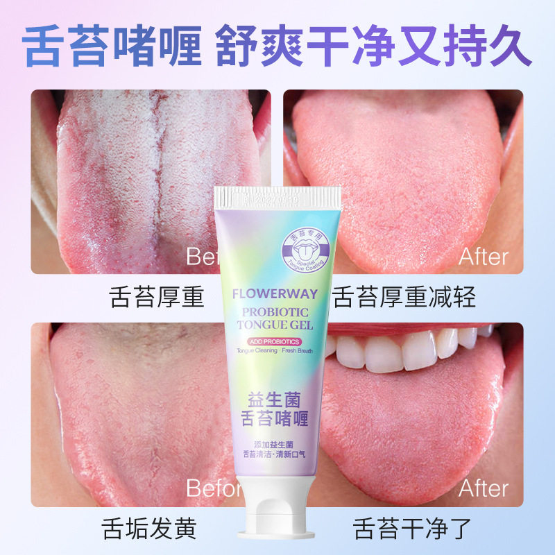 Flowerway Probiotic Tongue Coating Gel Cleans Tongue Coating, Removes Odor, Removes Bad Breath, Freshens Breath, Tongue Coating Curry