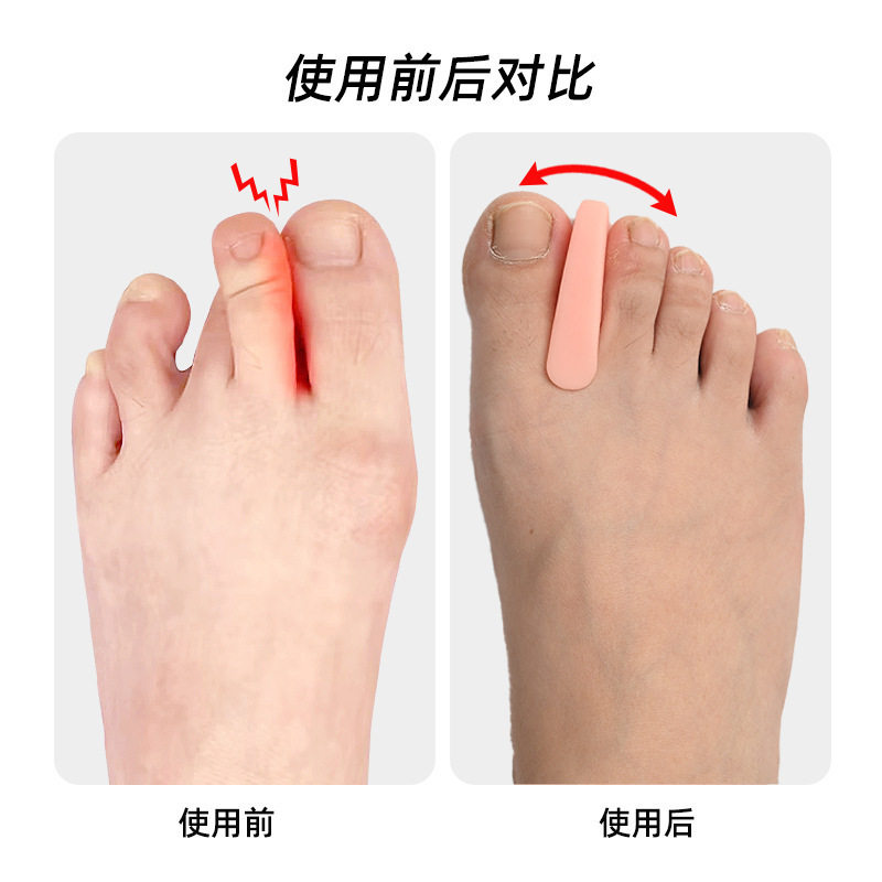 Japanese Toe Orthotic Toe Splitter Toe Separator Thumb valgus orthosis little toe inversion correction