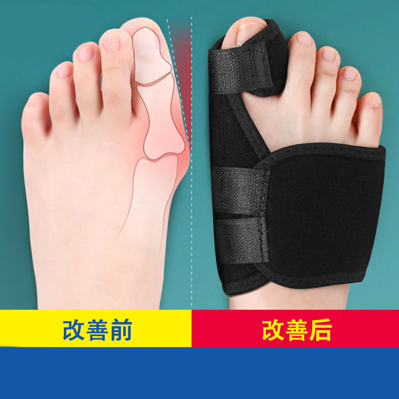 Thumb Valgus Separator for Big Toe Correction, Aluminum Material, Improves and Corrects Big Toe Deformity, Allows Wearing Shoes