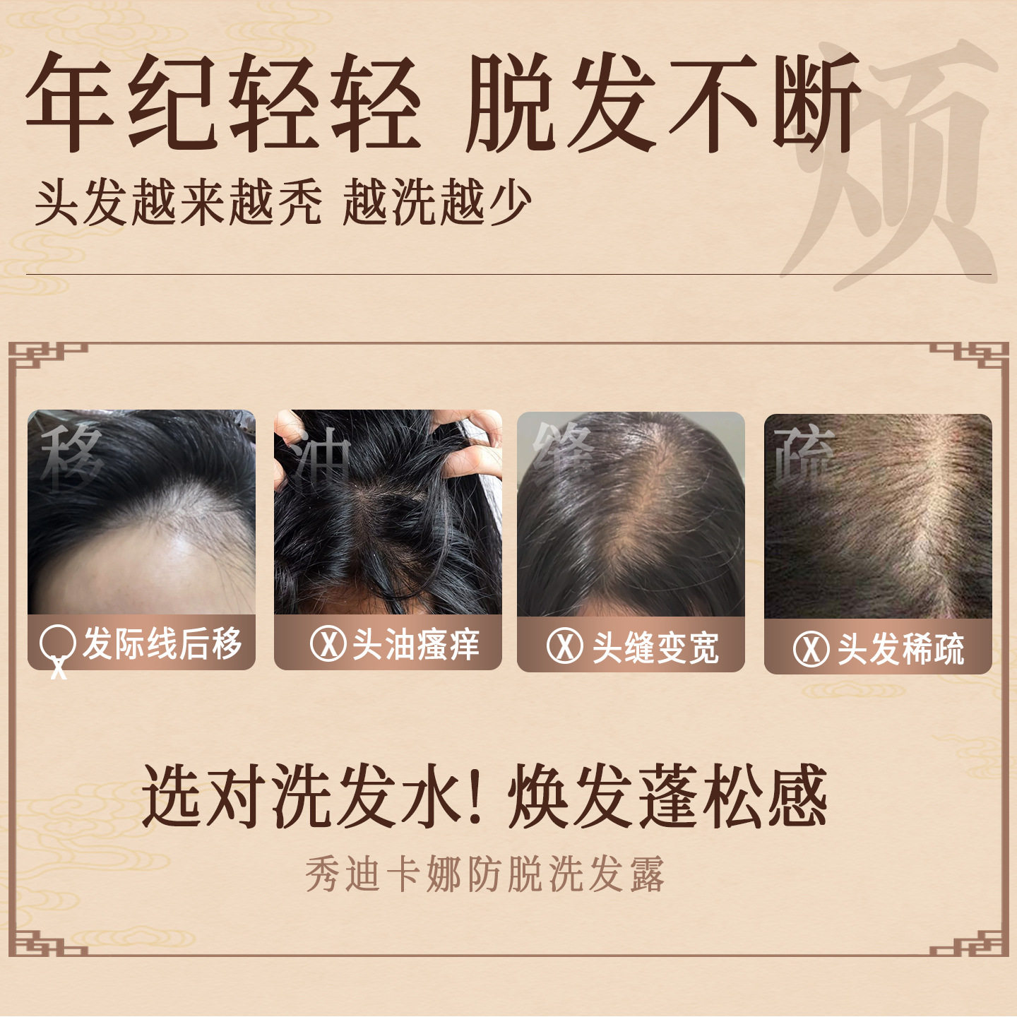 Live Broadcast Popular Anti-Hair Loss Shampoo, Strong Hair and Nourishing Hair, Ginger and Polygonum Multiflorum Shampoo Wholesale Customization