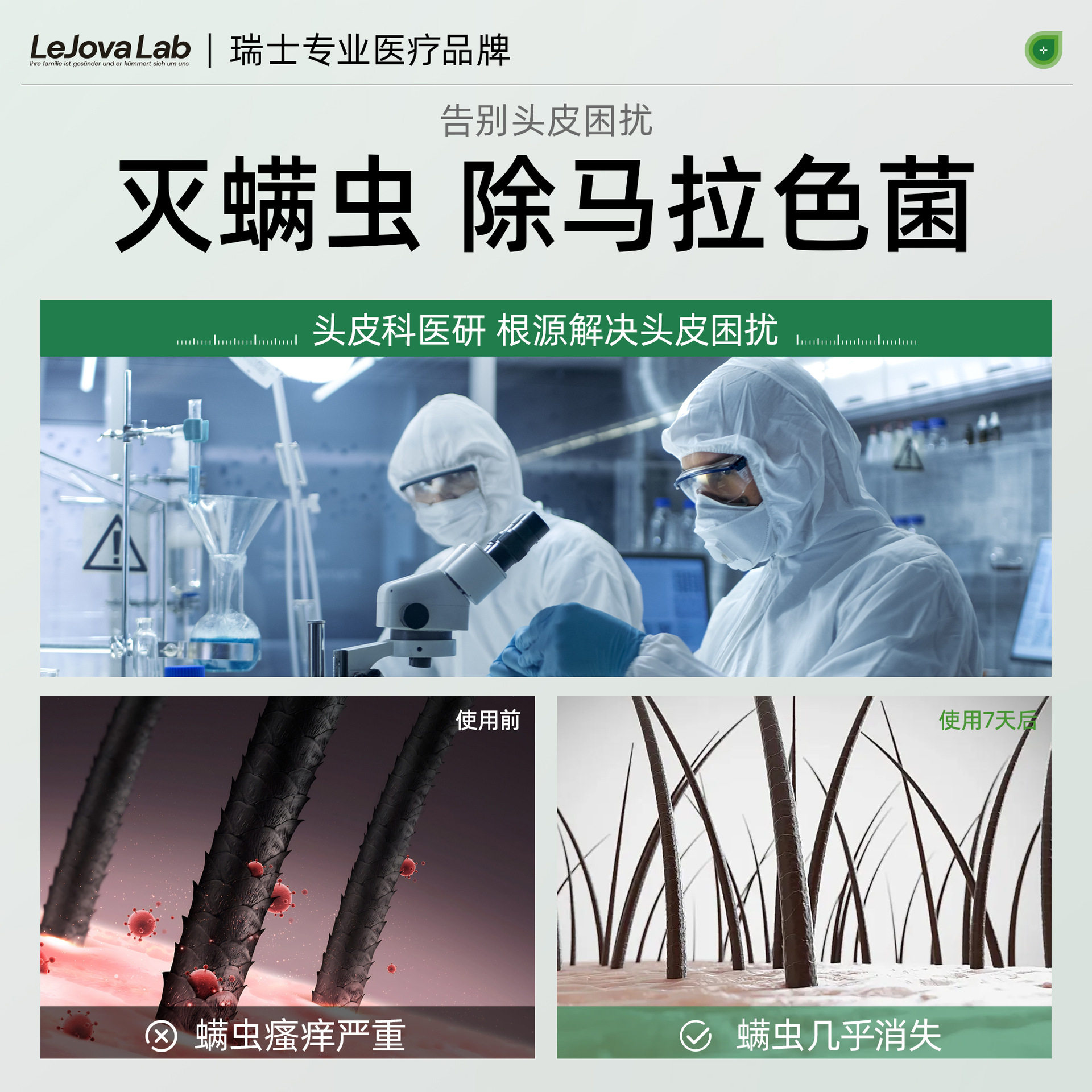 Coal Tar Lotion, Anti-Dandruff, Anti-Itch, Anti-Mite, Oil-Control, Anti-Bacterial Liquid Shampoo, Wholesale Refreshing Scalp Support, Customized Patch