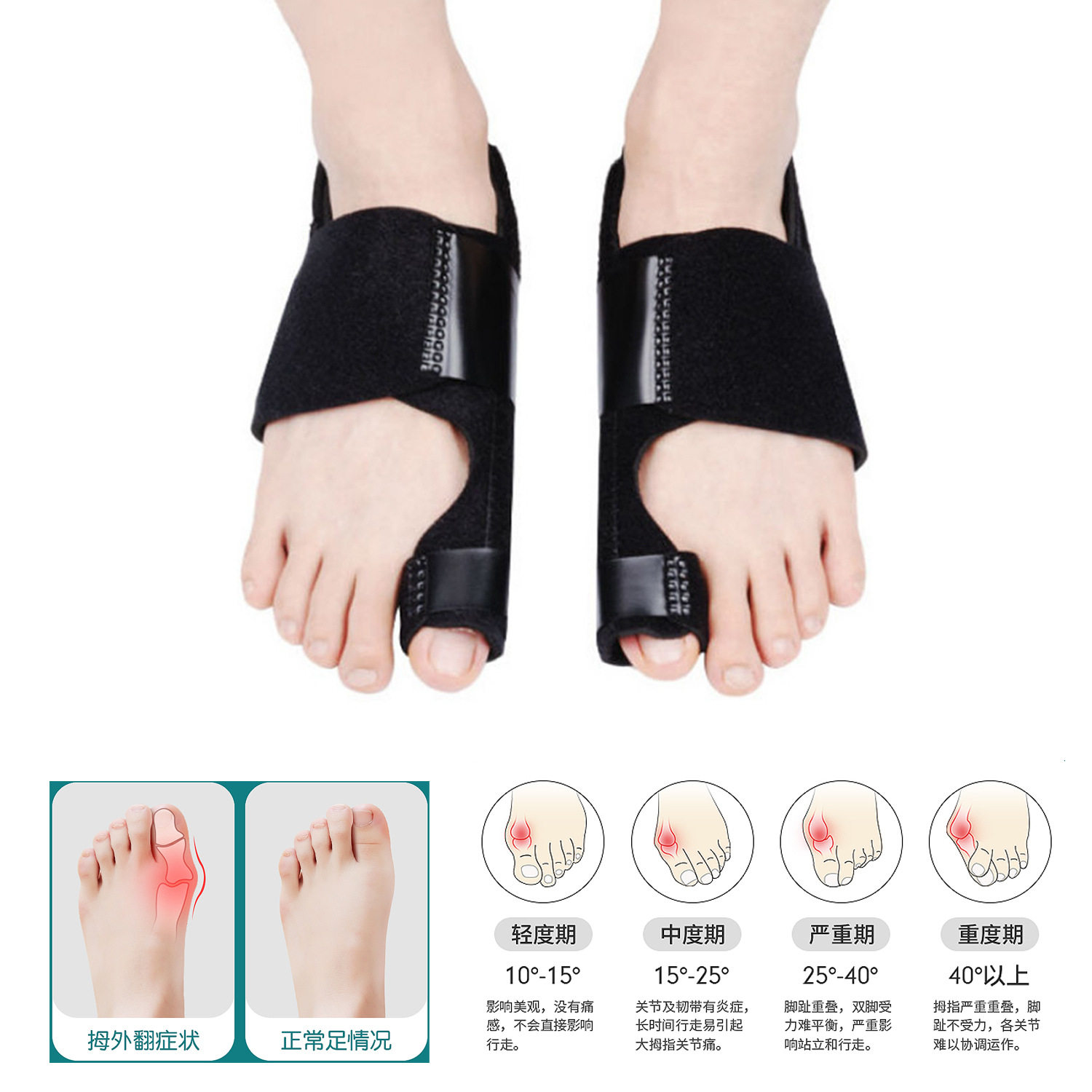 Amazon's Best-Selling Big Toe Valgus Corrector Can Be Used Day and Night to Separate Toes and Adjust Large Bones