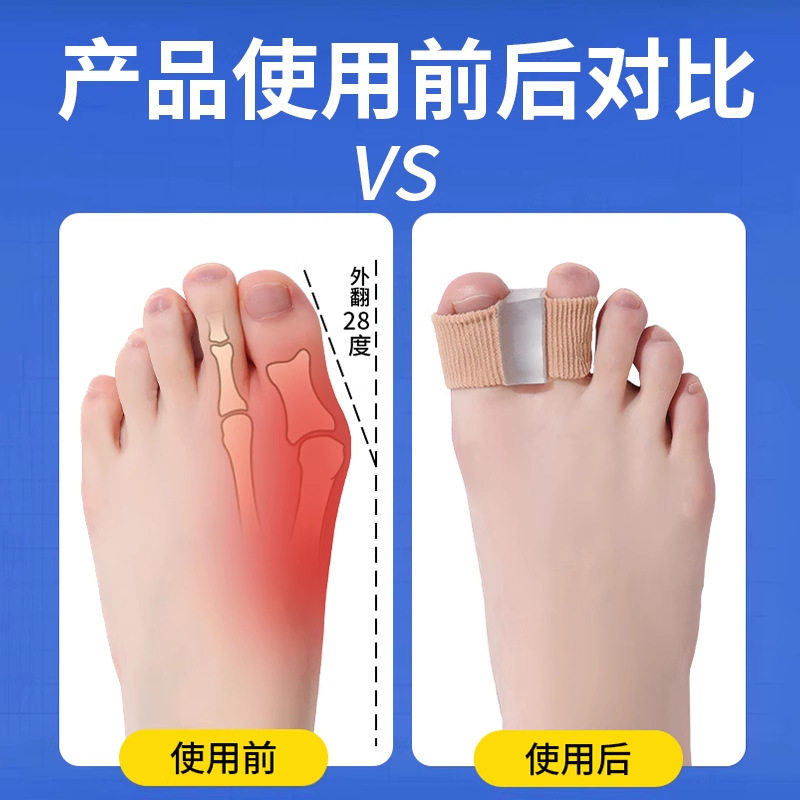 Toe Thumb Valgus Corrector Toe Separator for Men and Women Toe Separator