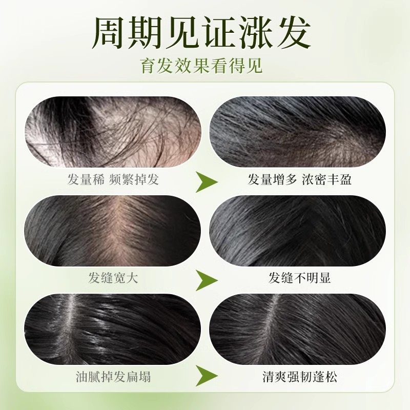 Yucatang Anti-Hair Loss Hair Growth Liquid Hair Growth Solid Hair Shampoo Oil Control Fluffy Anti-Dandruff Anti-Itch Shampoo Official Authentic Product