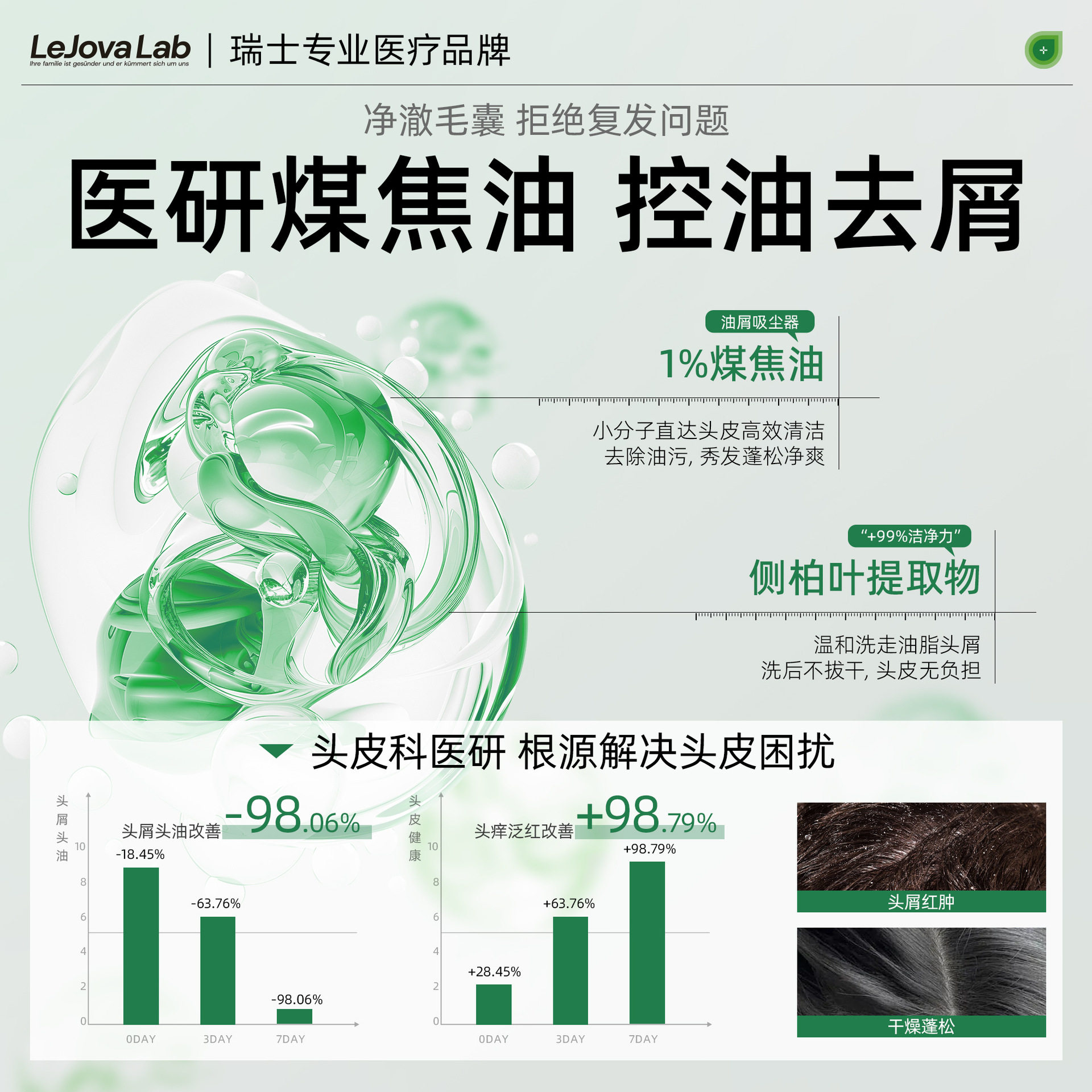 Coal Tar Lotion, Anti-Dandruff, Anti-Itch, Anti-Mite, Oil-Control, Anti-Bacterial Liquid Shampoo, Wholesale Refreshing Scalp Support, Customized Patch