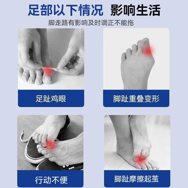 Japanese Brand Toe Anti-Wear Protective Cover Silicone Toe Sports Anti-Wear Foot Size Toe Corrector Anti-Squeezing Foot