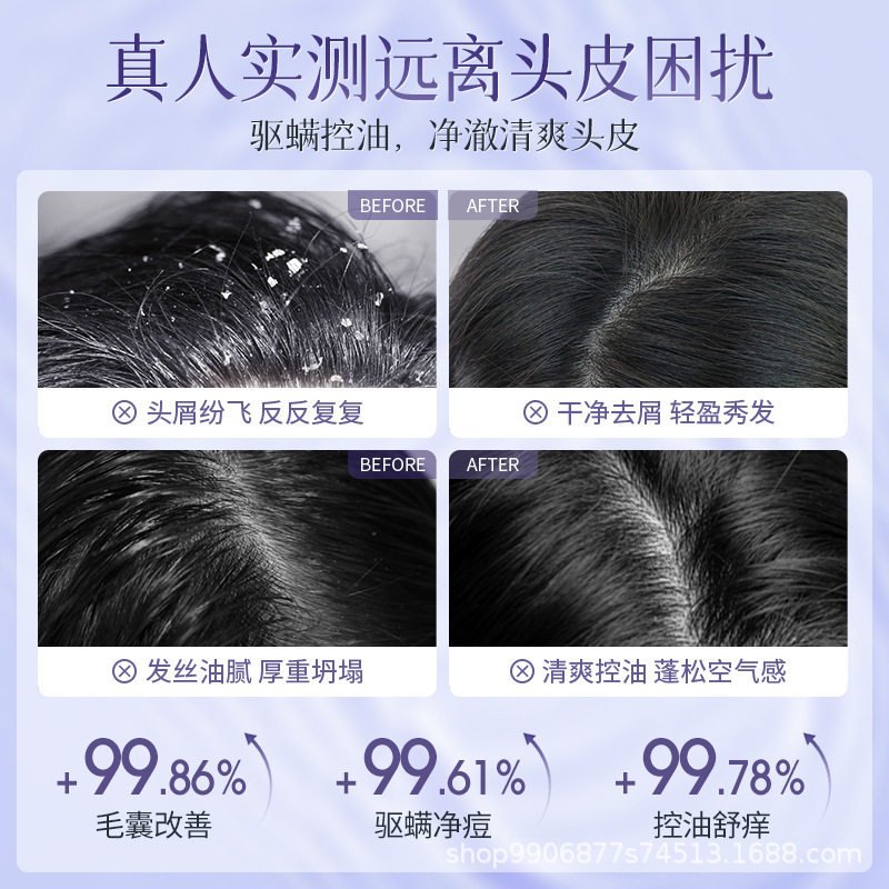 Three Magic Hair Craftsman Selenium Sulfide Shampoo Scalp Care Anti-dandruff Control Oil Fluffy Shampoo Shampoo Student