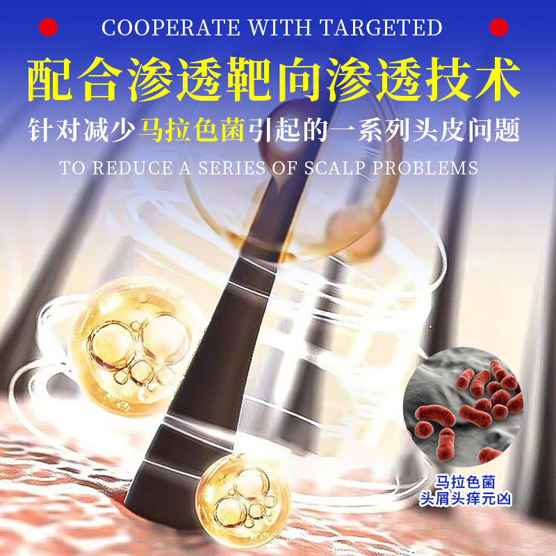 Likening selenium disulfide antidandruff Antibacterial shampoo antipruritic refreshing oil control compliant 300ml for men and women