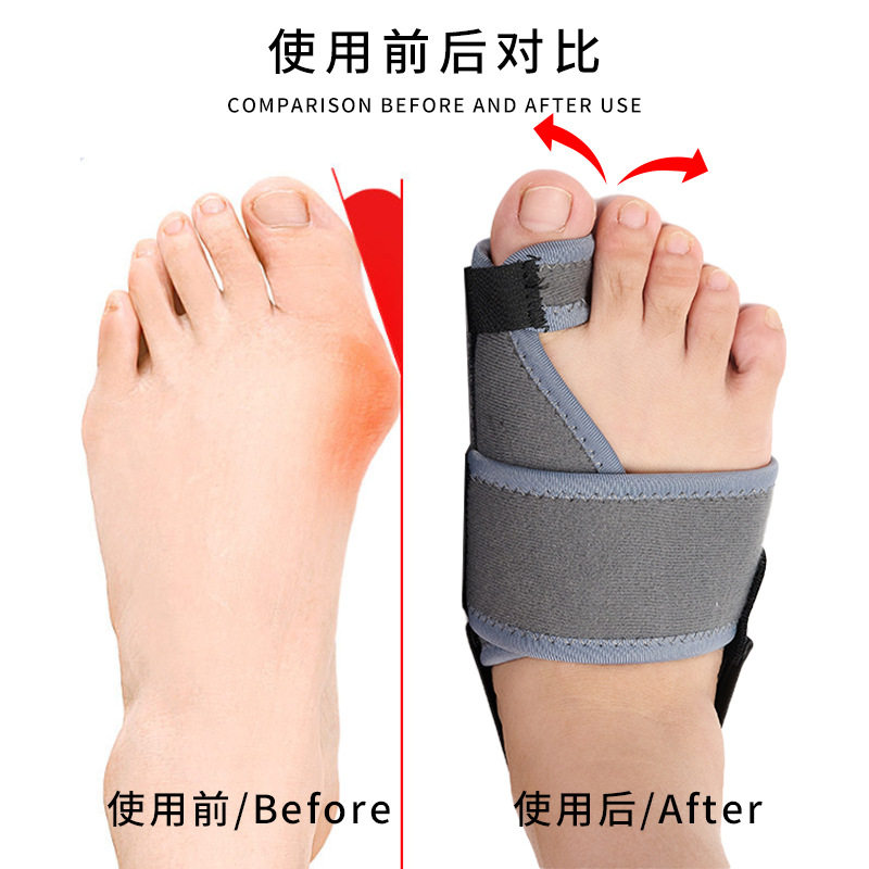 Big Toe Valgus Correction Belt Adjustable Thumb Valgus Corrector Aluminum Plate Pressurized Fixed Toe Separator