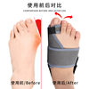 Big Toe Valgus Correction Belt Adjustable Thumb Valgus Corrector Aluminum Plate Pressurized Fixed Toe Separator