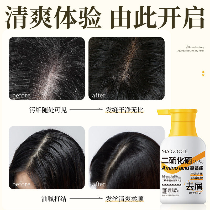 Meidelin selenium disulfide shampoo anti-dandruff anti-itching fluffy hair root Moisturizing Soft amino acid shampoo