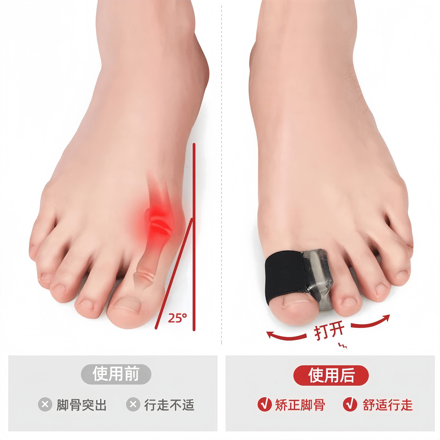 Toe Valgus Corrector Big Toe Bone Correction Artifact Silicone Toe Separator Men's and Women's Foot Shape Correction Wholesale