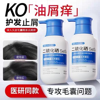 Beilingmei selenium disulfide oil control dandruff shampoo hair follicle cleaning oil control fluffy antipruritic shampoo genuine goods