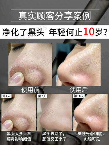 Tongrentang, комплект от черных точек, отрывные носовые полоски, маска для лица, сужает поры