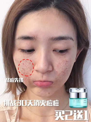 海洋诗韵 Осветляющая мазь, скрывает прыщи, анти-акне, сужает поры