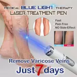 Heath Blue Light Therapy Varicose VE Learch Lazer Pen SOF