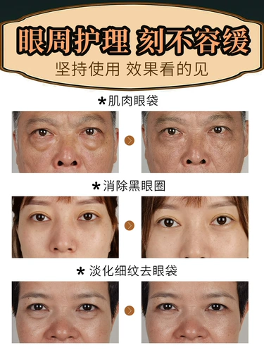 Осветляющая маска для глаз от мешков под глазами, подтягивающие патчи для глаз, против темных кругов под глазами, против морщин