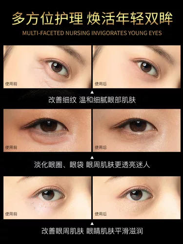 Разглаживающий пептид, осветляющий крем для глаз, против морщин, против темных кругов под глазами