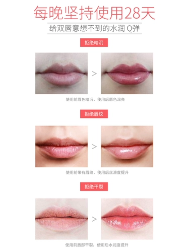 [Сяохонгу горячая маска для губ] Улучшение тусклой губы угла рта, цвет губы, чтобы исчезнуть линии губ, чтобы увлажнить мертвую кожу