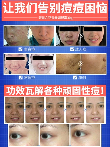 Восстанавливающая осветляющая эссенция подходит для мужчин и женщин от черных точек, анти-акне, скрывает прыщи