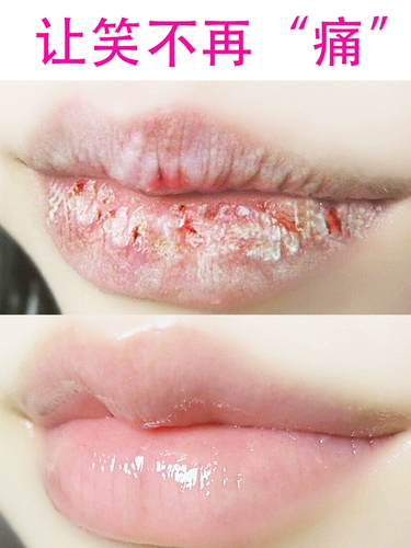 [Сяохонгу горячая маска для губ] Улучшение тусклой губы угла рта, цвет губы, чтобы исчезнуть линии губ, чтобы увлажнить мертвую кожу