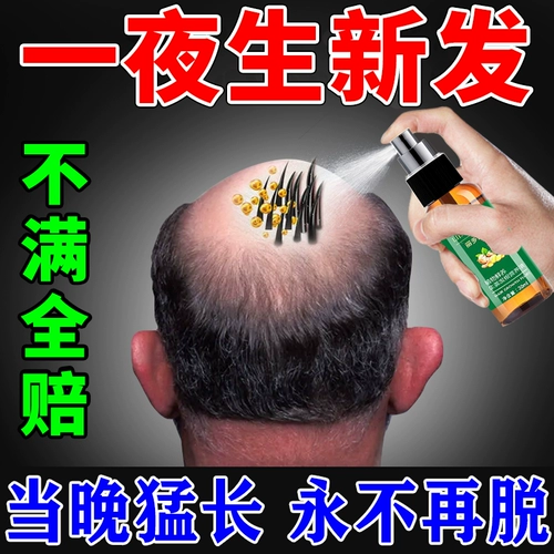 Сохранить лысой/волос после движения/алопеция ареата и т. Д.