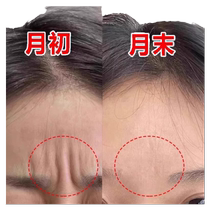 (Xiaohongshu’s best-selling farewell to Sichuan pattern) Anti-wrinkle iron forehead patch for anti-aging forehead protection artifact~~~