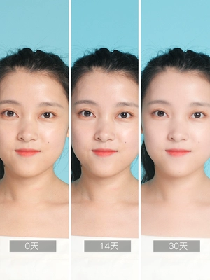 Zhenlan Chamomile Cream Nữ sinh viên đặc biệt Hydrating Da nhờn dưỡng ẩm Ngày hè và ban đêm Sửa chữa dưỡng ẩm - Kem dưỡng da