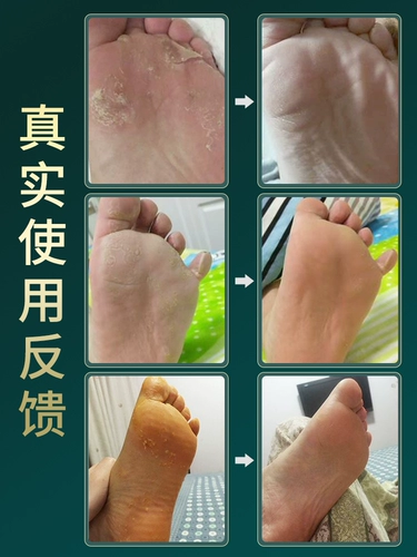 Turdown и Trifa Trivia, Blade Boom Bubble Peeling Brand