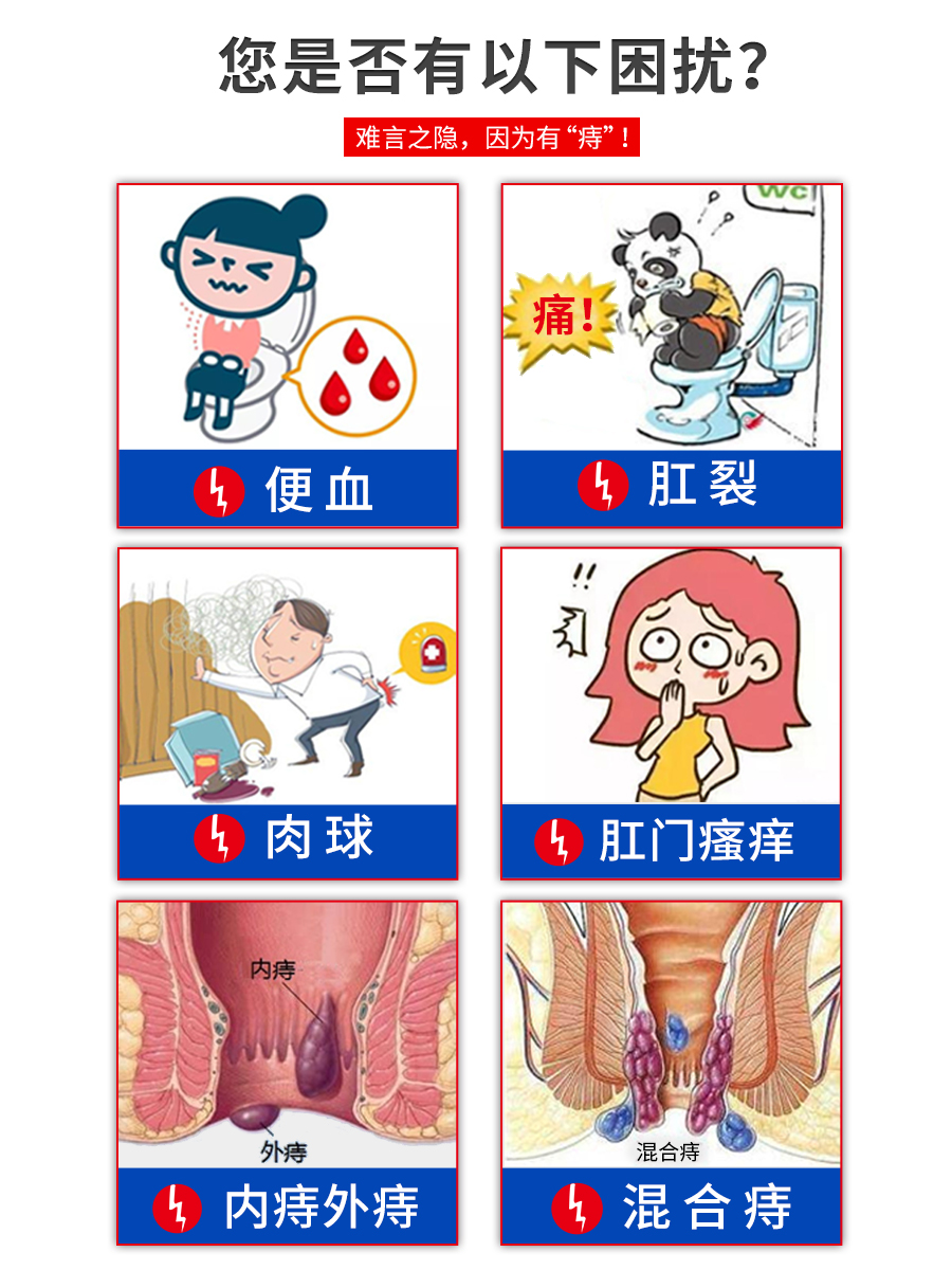 药房直售 科美臣 痔疮膏 3盒 消内外痔肉球 图2