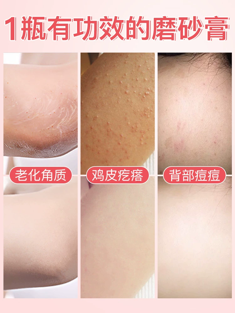 Flute tình yêu cơ thể chà, cơ thể tẩy da chết, da gà, nang tóc, đùi, điều dưỡng, vẻ đẹp, trở lại, trắng