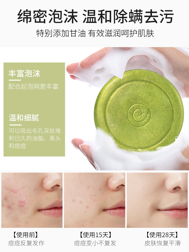 Rửa mạt xà phòng lưu huỳnh và mạt ngoài cơ thể muối biển lưu huỳnh sâu làm sạch bọ xà phòng mặt Lesbian đi