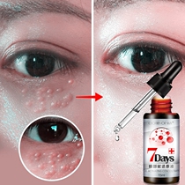 Remove fat particles artifact Eliminate fat particles Face sweat tube special cream Student eye removal liquid Japanese tumor