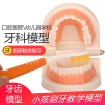 Dental model Kindergarten early education brushing mold standard double denture department children baby oral teaching props