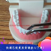 Childrens tooth extraction tweezers Childrens tooth extraction forceps Tooth extraction shaking tooth root tweezers Stainless steel material can be disinfected