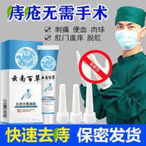 Zhixiao hemorrhoid Shu Bao gel Yunnan broken hemorrhoid cream hemorrhoid root broken to eliminate meat ball female artifact Kapom mole