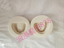 Dental Stomatology edentulous jaw edentulous female mold standard dental column printed as plaster model