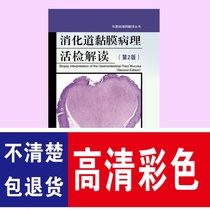 Interpretation of pathological biopsy of digestive mucosa (2nd edition)