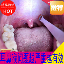 Tonsil stone removal tool tonsil stone removal artifact tonsil stone suction tonsil