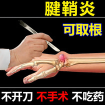 Jiaruis tendon sheath tendon sheath swollen bladder thumbs thumbs numbness health Tongshu paste
