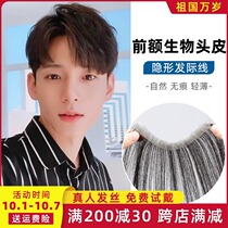 Hairline wig patch forehead invisible man repair hairline true hair stick fake bangs male M-type wig reissue