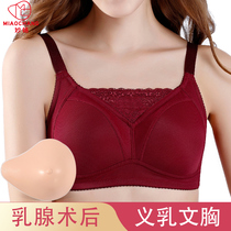 Miaochang prosthetic breast bra Two-in-one lightweight silicone fake breast breast bra postoperative underwear fake breast womens special summer